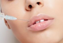 Lip Filler