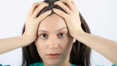Receding Hairline